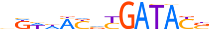 SIX2.H13RSNP.1.M.C motif logo (SIX2 gene, SIX2_HUMAN protein)